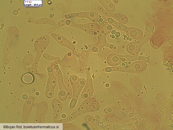 Atheniella leptophylla