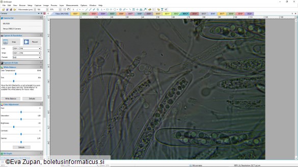 Ascocoryne inflata