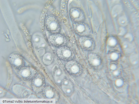 Octospora phagospora