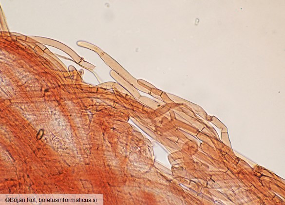 Pseudosperma obsoletum