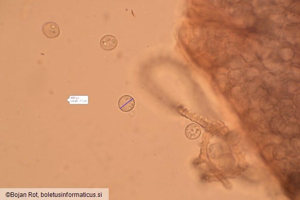 Arcyria denudata