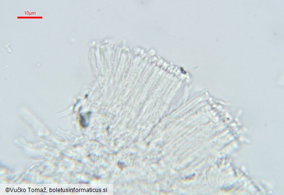 Polycephalomyces ditmarii