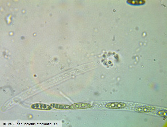 Lopadostoma dryophilum