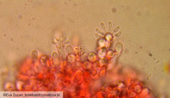 Sistotrema brinkmannii