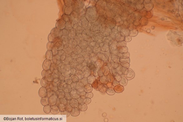 Arcyria denudata