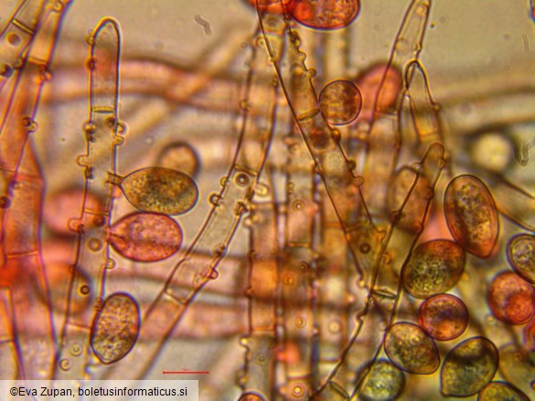 Botryobasidium conspersum
