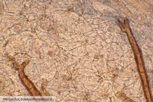 Scutellinia scutellata