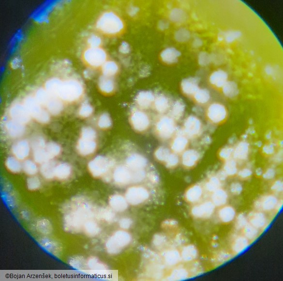 Pseudomicrostroma juglandis