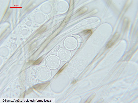 Pseudoplectania nigrella