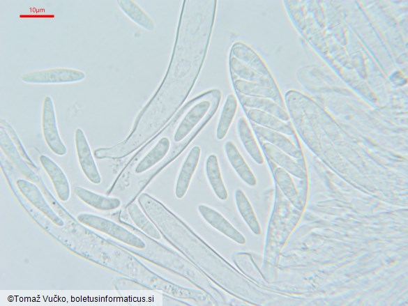 Arachnopeziza leonina