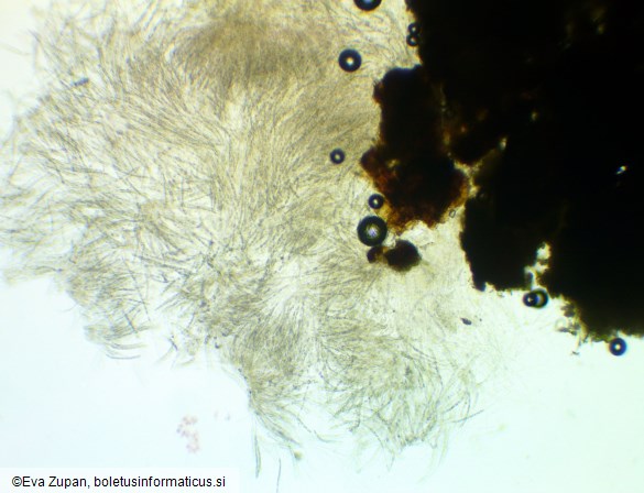 Phomatospora berkeleyi