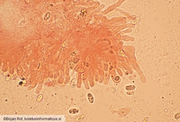 Pseudotricholoma metapodium