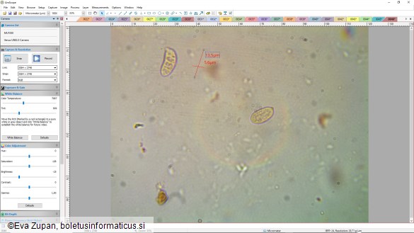 Dacrymyces lacrymalis