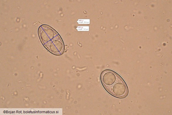 Psilopezia nummularia
