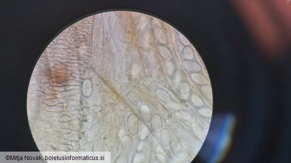 Lasiobolus ciliatus