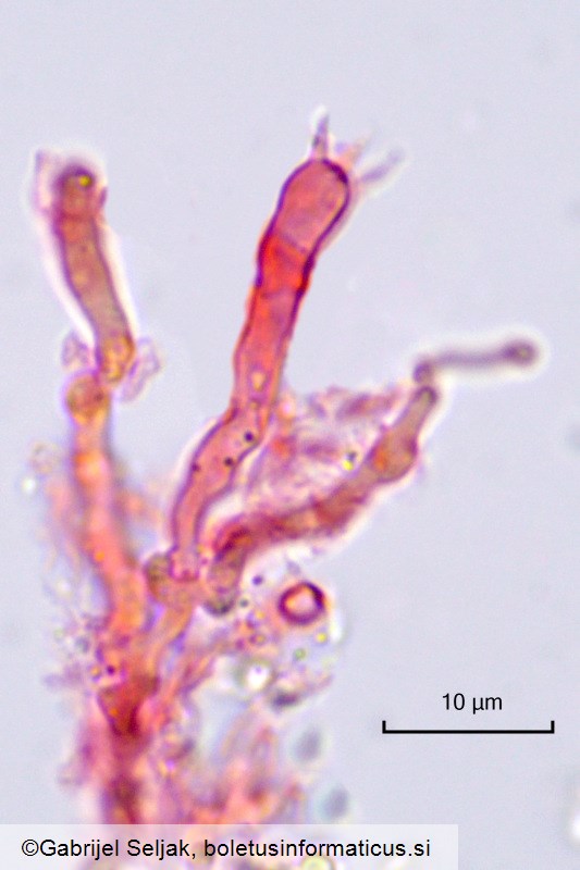 Gloeocystidiellum clavuligerum