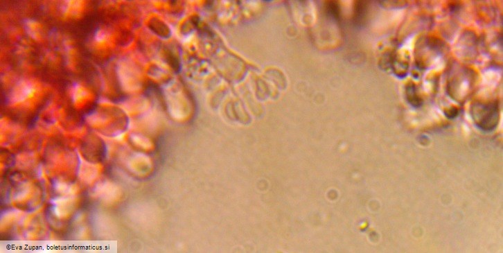 Sistotrema brinkmannii