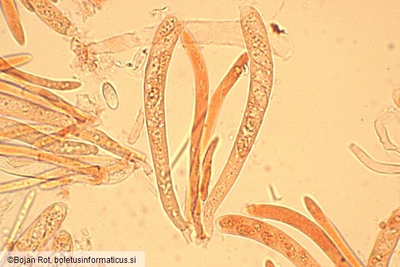 Hymenoscyphus imberbis