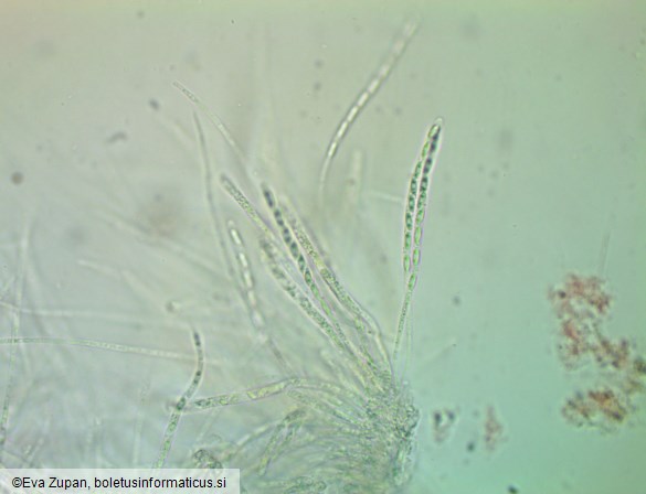 Phomatospora berkeleyi