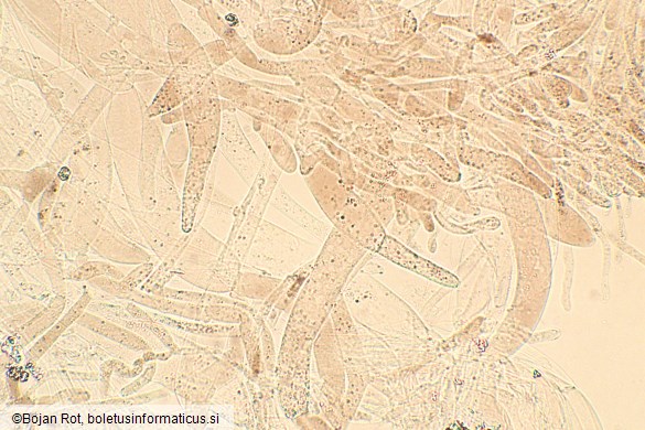 Entoloma undulatosporum