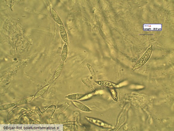 Hypomyces lateritius