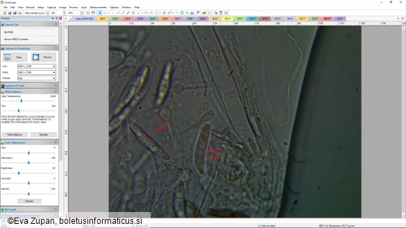 Ascocoryne inflata