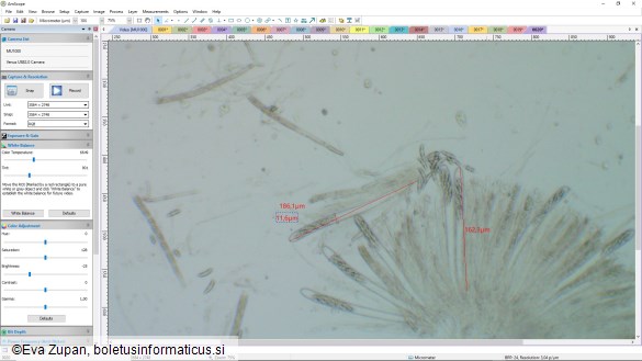 Ascocoryne inflata