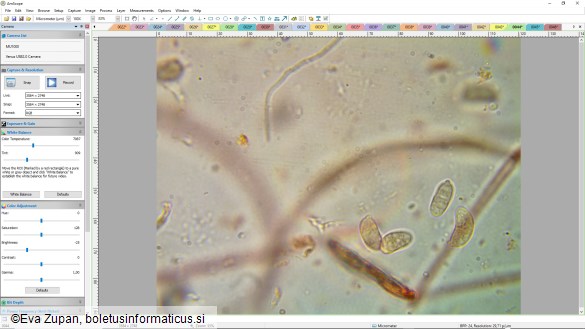 Dacrymyces lacrymalis