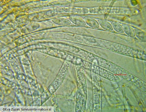 Hymenoscyphus eichleri