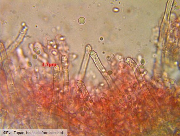 Amphinema byssoides
