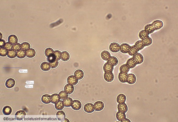 Aspergillus flavus