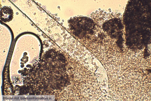 Aspergillus flavus