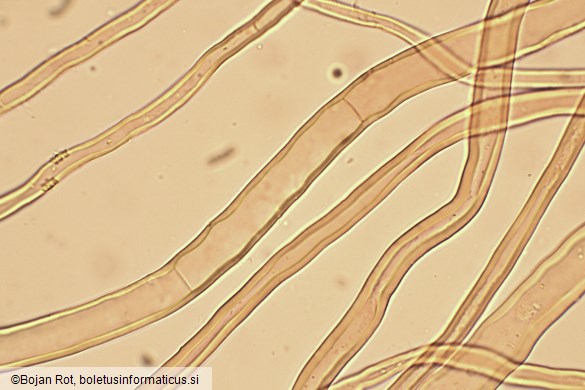 Tulostoma squamosum