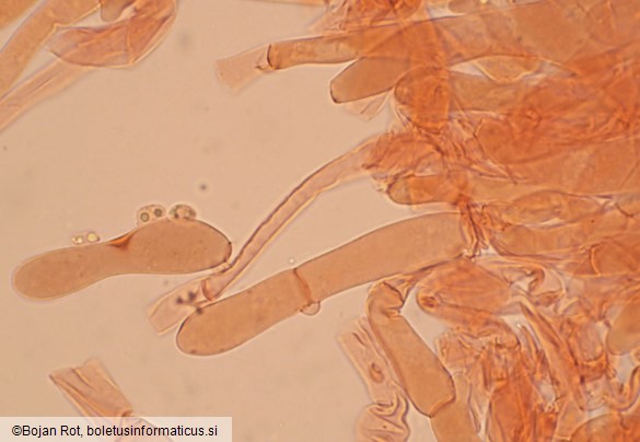 Spodocybe trulliformis