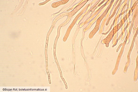 Calocera glossoides