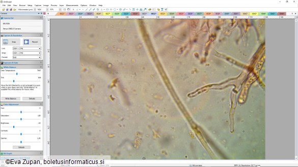 Dacrymyces lacrymalis