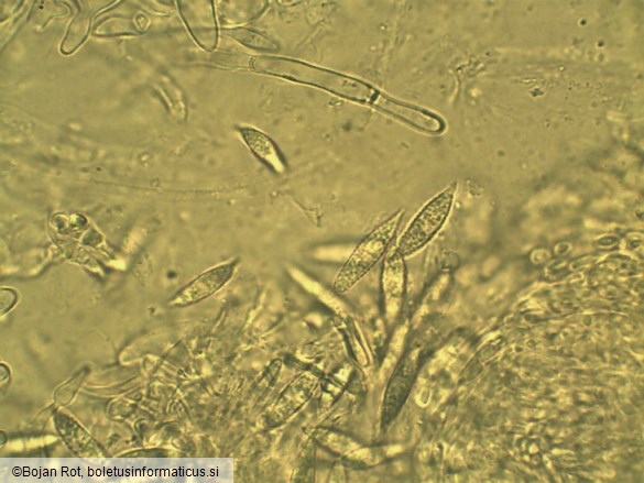 Hypomyces lateritius