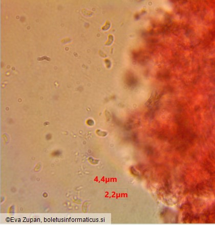 Sistotrema brinkmannii