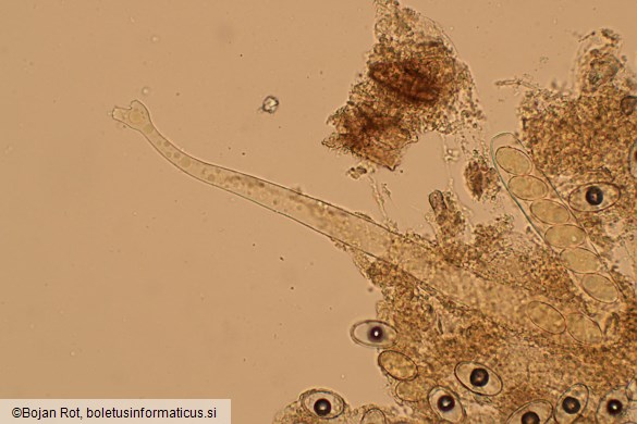 Psilopezia nummularia