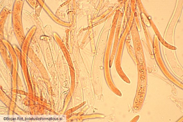 Hymenoscyphus imberbis