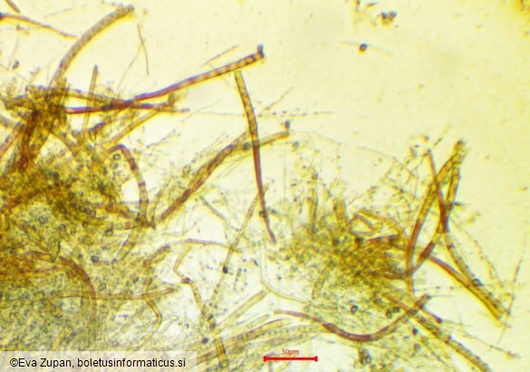 Hymenoscyphus eichleri
