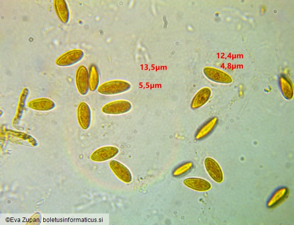Hymenoscyphus eichleri