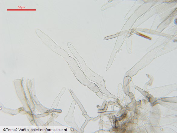 Lepiota griseovirens