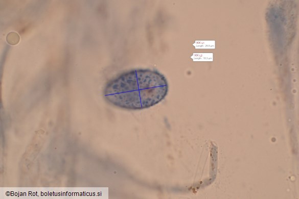 Scutellinia scutellata