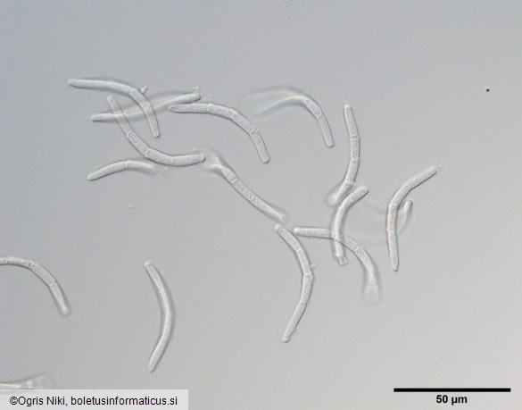 <i>Sphaerulina quercicola</i>