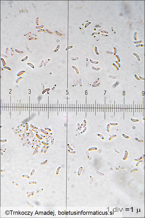 Tectella patellari
