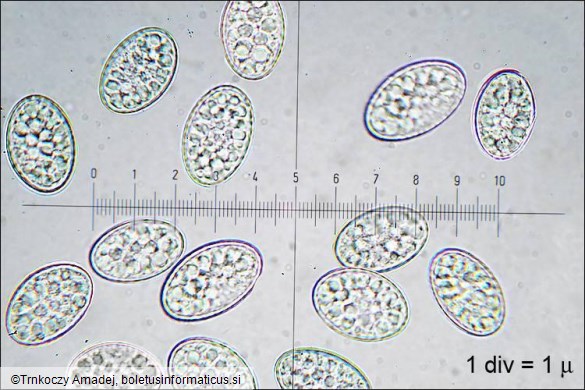 Scutellinia kerguelensis