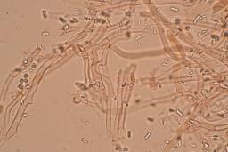 Byssomerulius corium