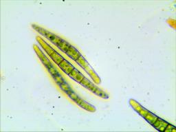 Leptosphaeria acuta