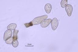 Spilocaea pyracanthae